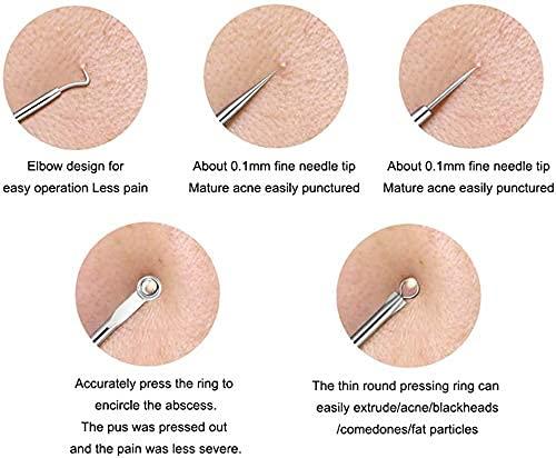 Stainless Steel Blackhead Remover ( set of 4 )