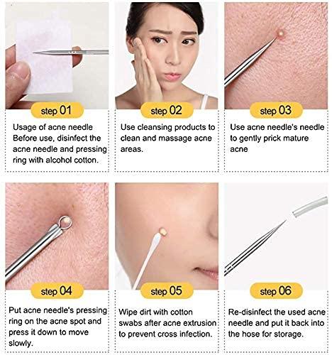 Stainless Steel Blackhead Remover ( set of 4 )