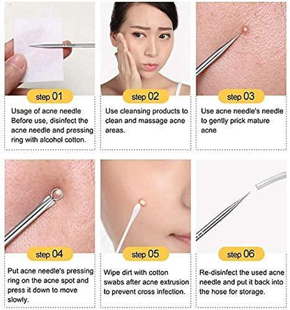 Stainless Steel Blackhead Remover ( set of 4 )